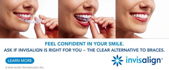 invisalign clear braces